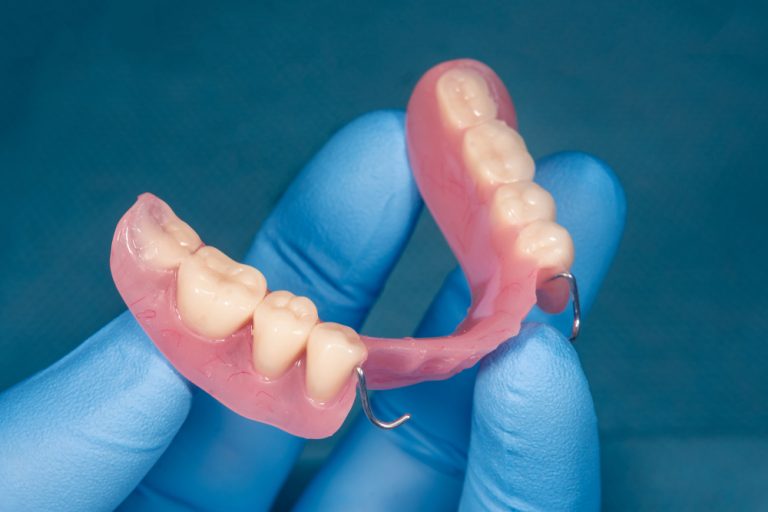 Quanto tempo dura uma prótese dentária removível? - Prime Odonto